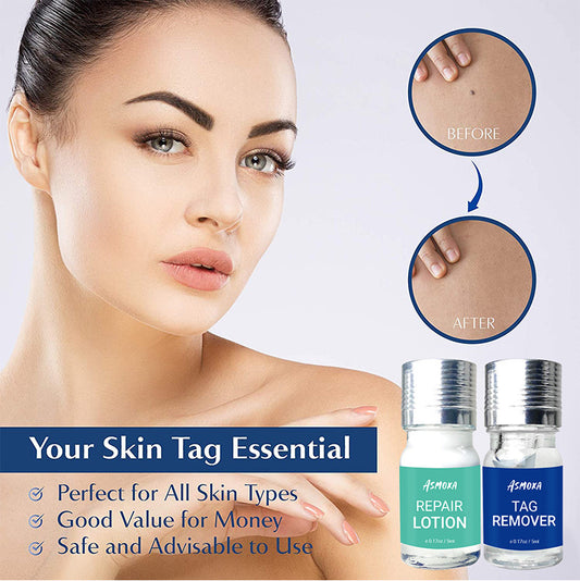 Skin Tag Mole & Wart Remover Set