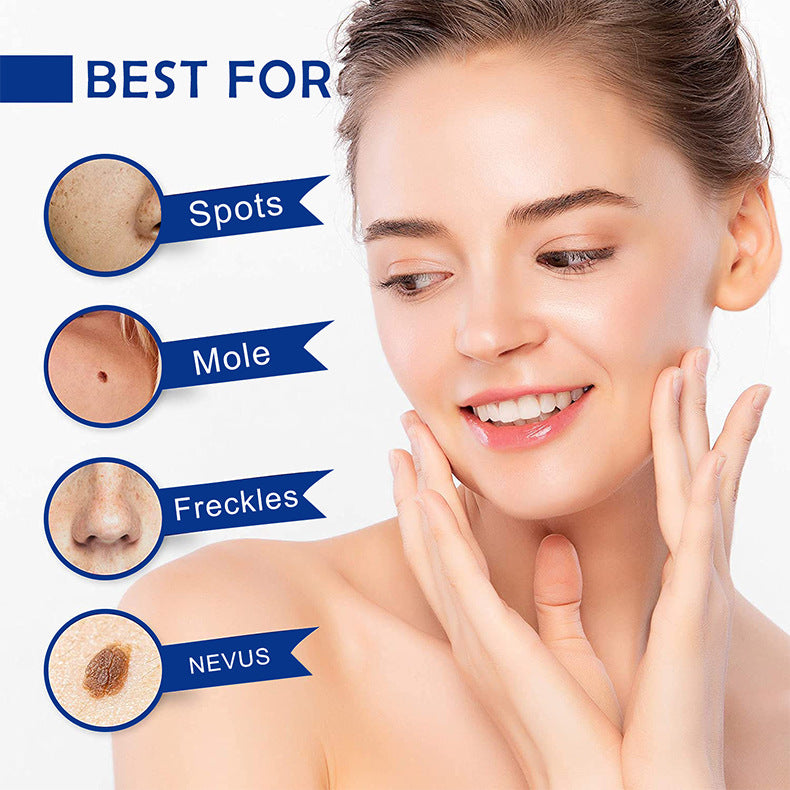 Skin Tag Mole & Wart Remover Set