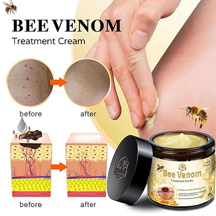 Bee Venom Mole and Wart Treatment Cream